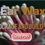 Ear Wax Removal North London