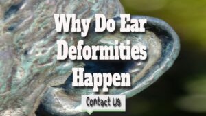 Why Do Ear Deformities Happen – Do Ears Change As You Get Older