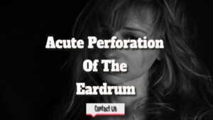 An Eardrum Has Ruptured—Acute Perforation Of The Eardrum.