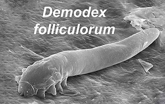 330px Demodex Folliculorum Sem Crop